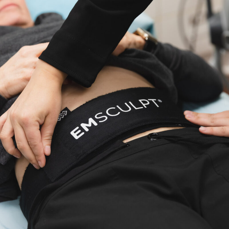 Emsculpt Neo Abdomen treatment at Renew Wellness & Aesthetics in Oklahoma City