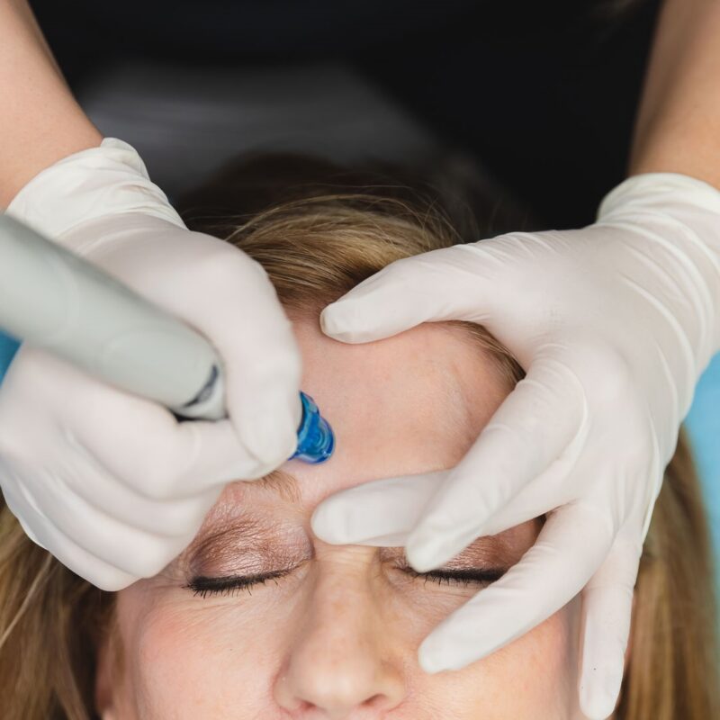 Hydrafacial on woman from above