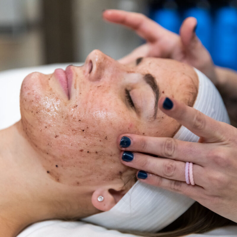 facial for skin rejuvenation treatment in Oklahoma City