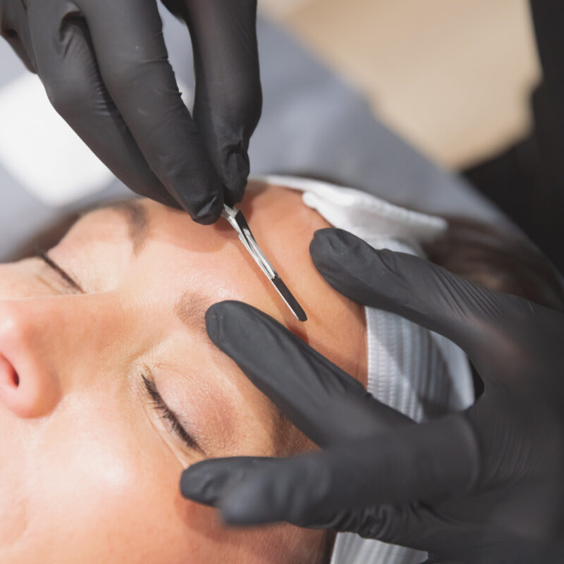 dermaplaning on client face in Oklahoma City