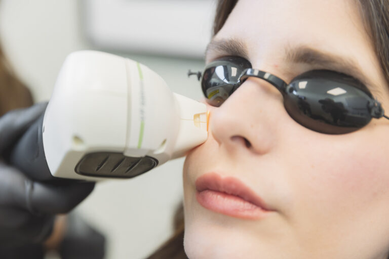 woman getting an ipl facial