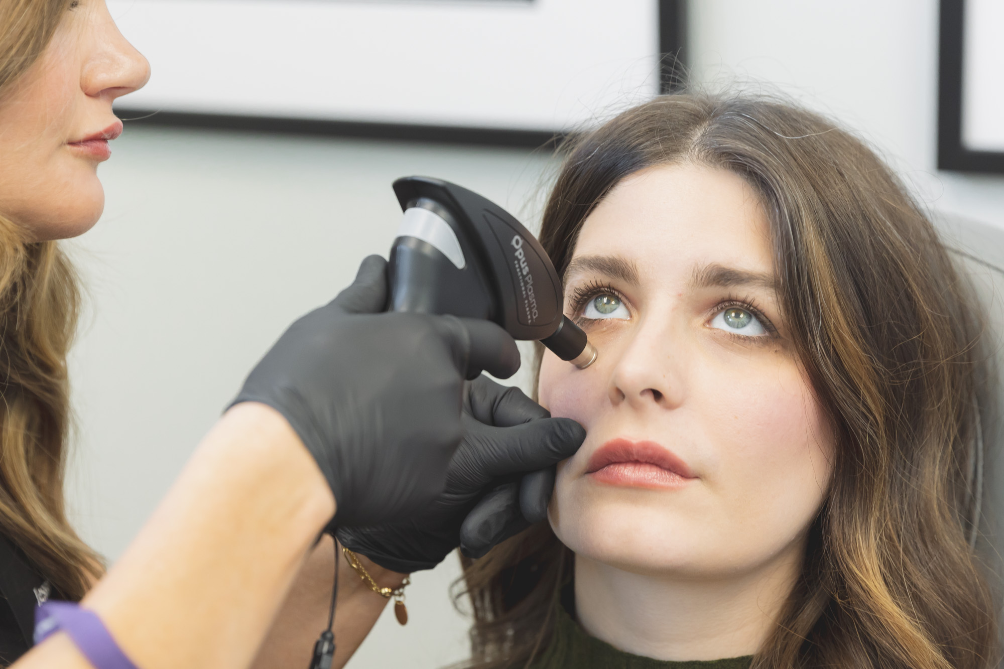 photo of woman receiving opus plasma for sun damage treatment OKC