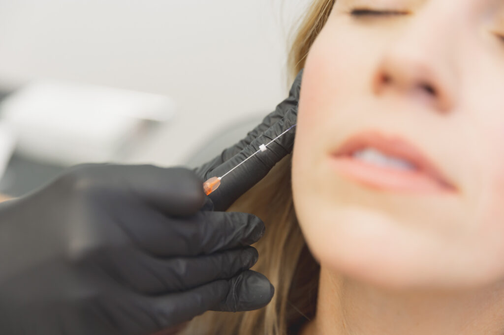 woman getting pdo threads done up close