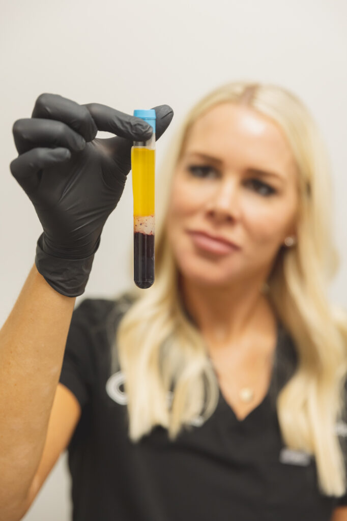 photo team member holding prp vial