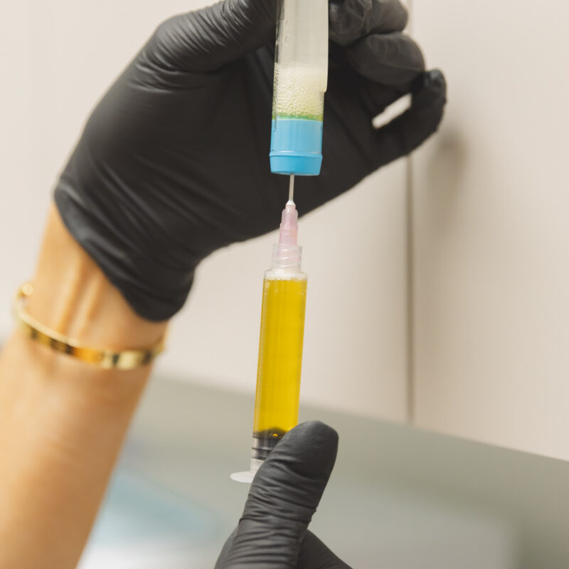 picture of hair restoration needle