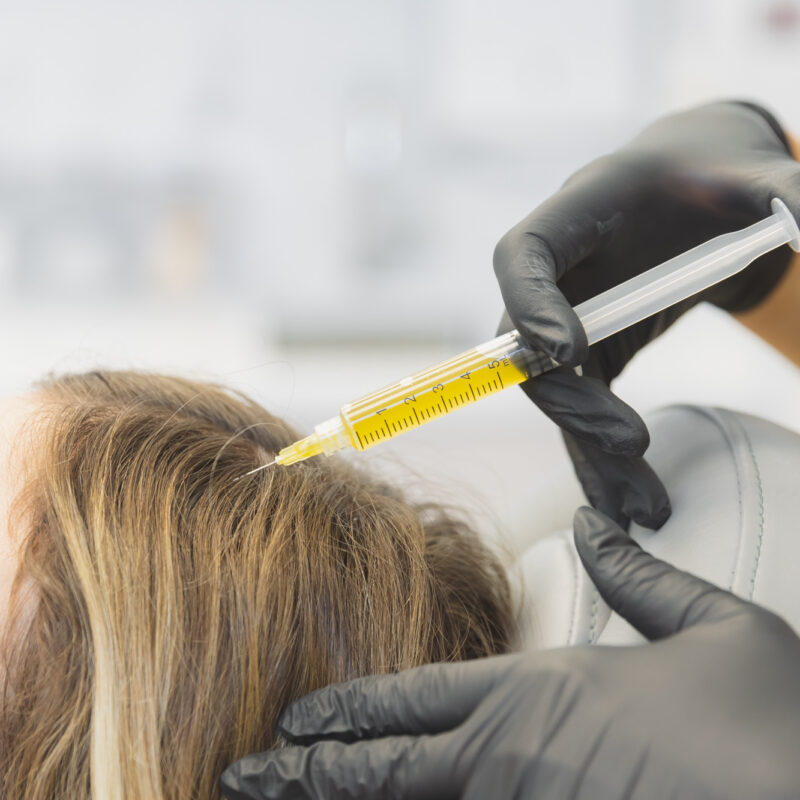photo of woman receiving prp hair restoration