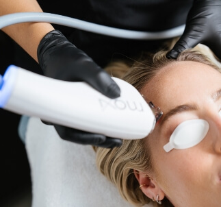 Moxi Laser Treatment in Oklahoma City reduces pigment and improves the skin's overall tone and texture