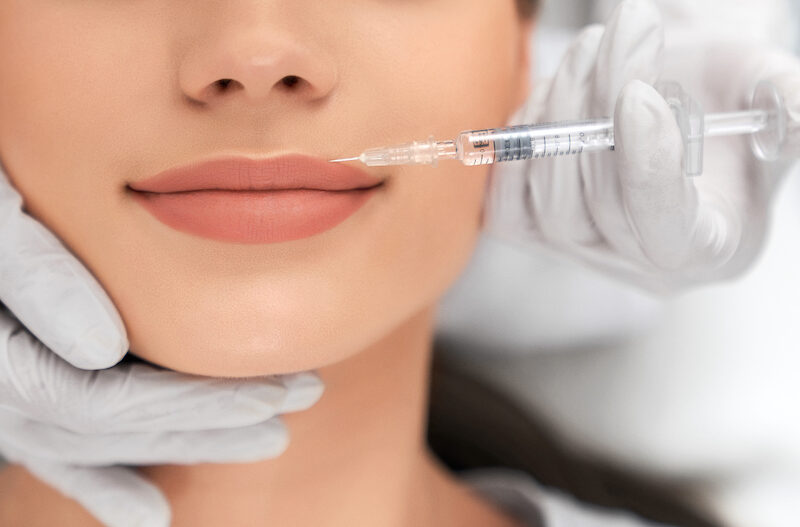 Patient receiving lip filler in Oklahoma City