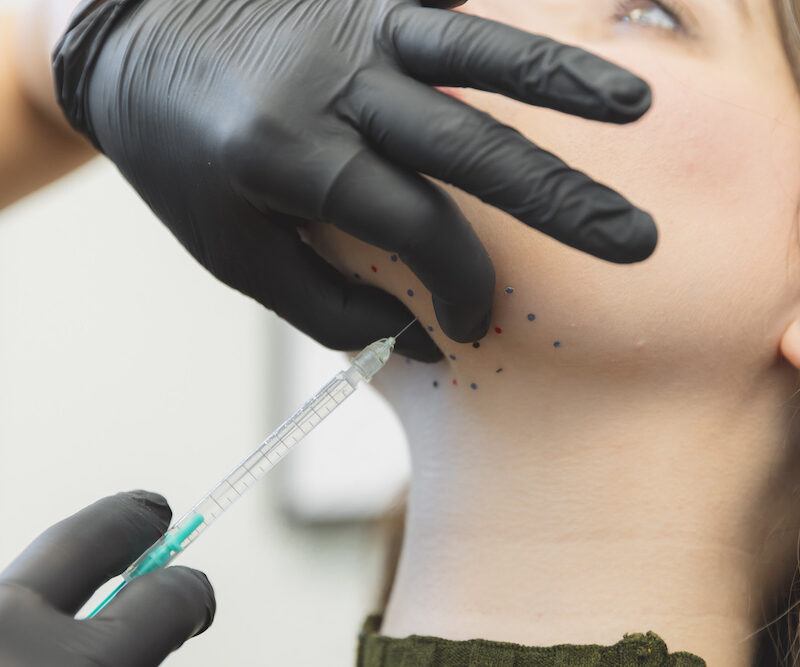 Patient receiving treatment for double chin removal in OKC